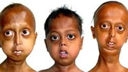 The 80-Year-Old Children