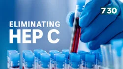 Eliminating Hepatitis C