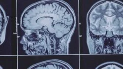 Unlocking the Sixth Sense