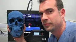 My Blue Skull