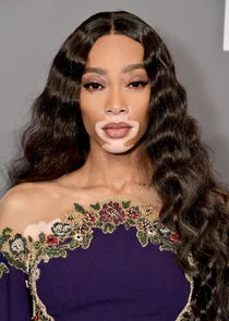 Winnie Harlow